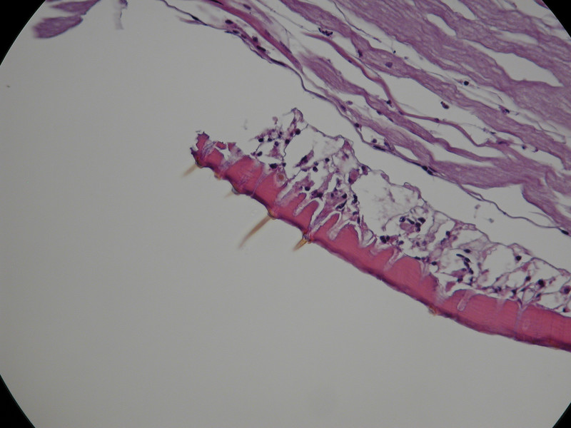 Antenna - distal end