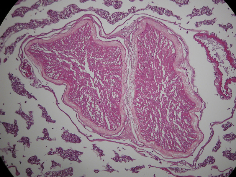 Ventral Nerve Cord