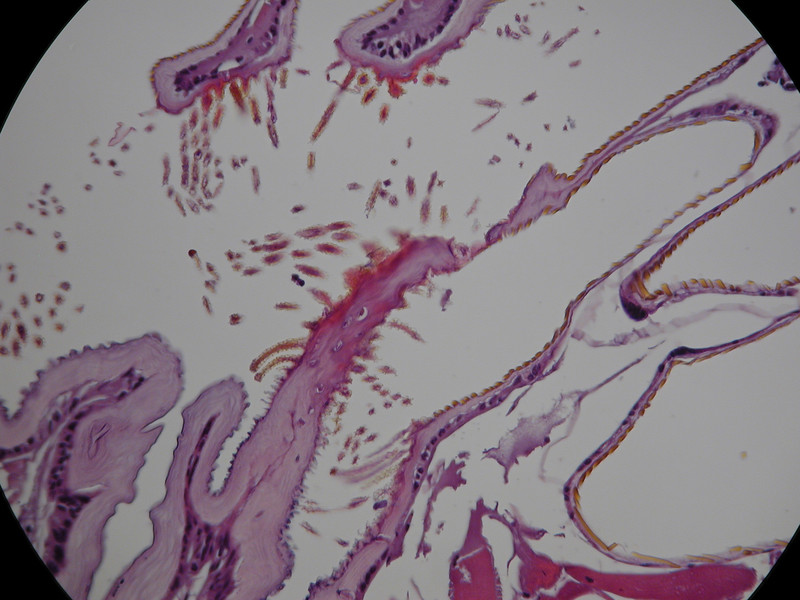 Spiracle filtering hairs